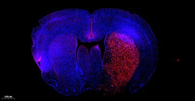 TMR (crveni) set za otkrivanje apoptoze stanica tunela